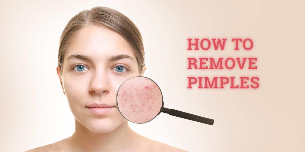 get rid of pimples in simple ways