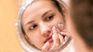 Get rid of Pimples in simpleways