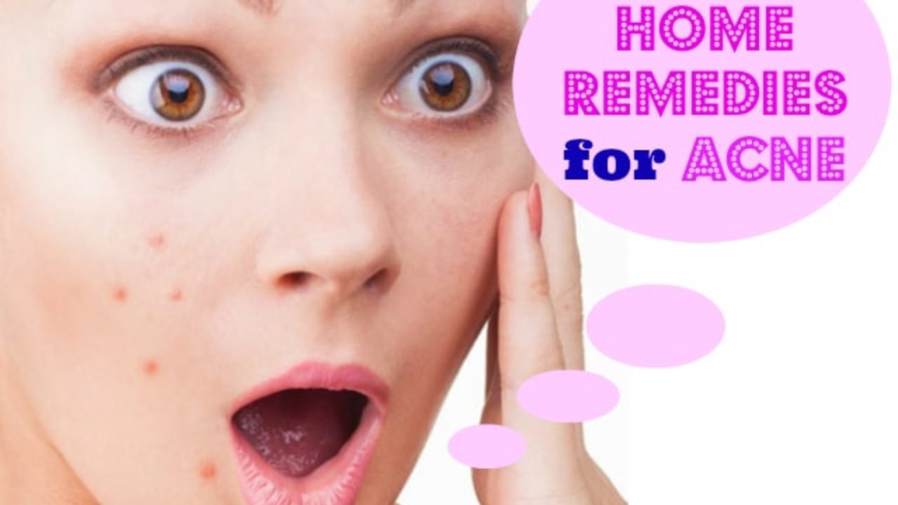 How to get rid of pimples | Top 50 home remedies for pimples