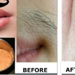 How to get rid of facial hair