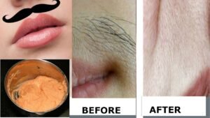 How to get rid of facial hair
